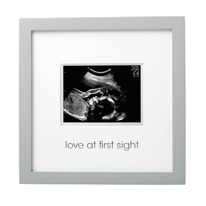 Sonogram Frame