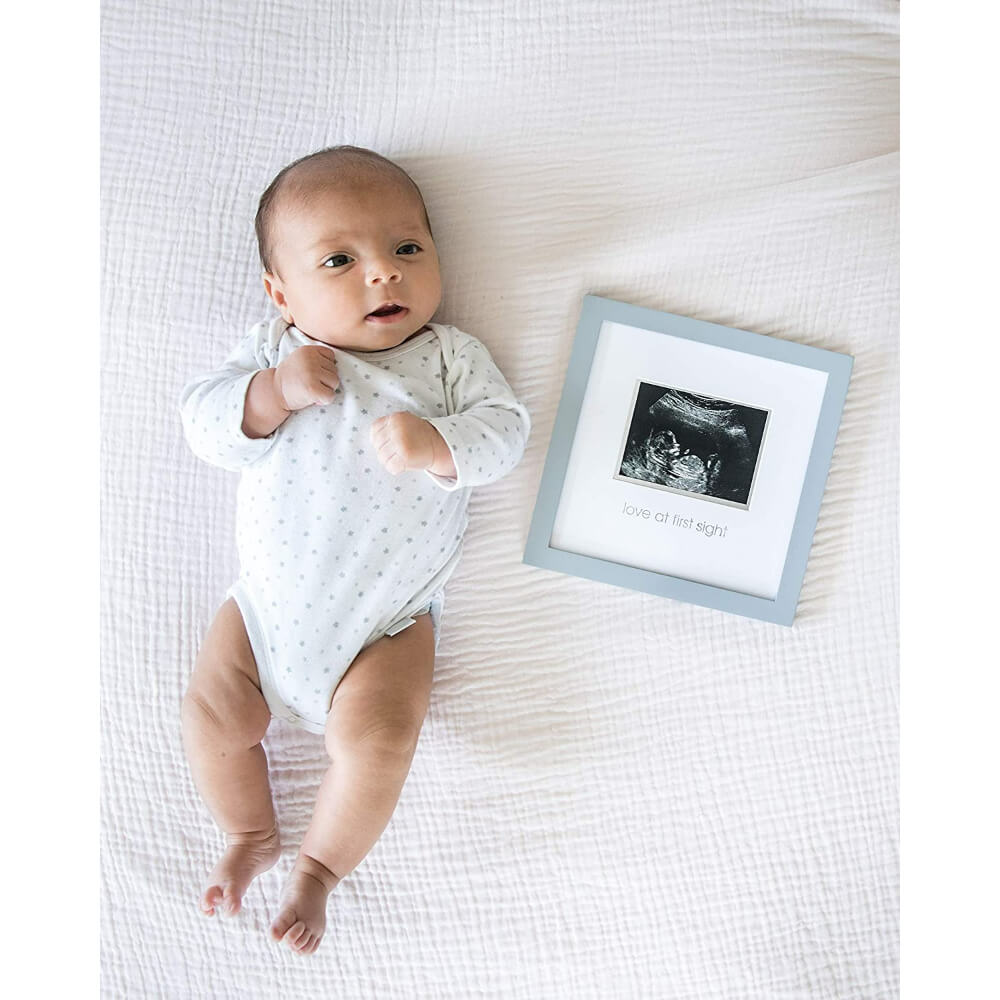 Sonogram Frame